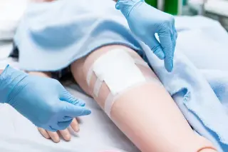 Scar treatment